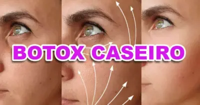 Botox caseiro com 2 ingredientes rejuvenesce às 50+, dá fim às rugas e traz pele de porcelana