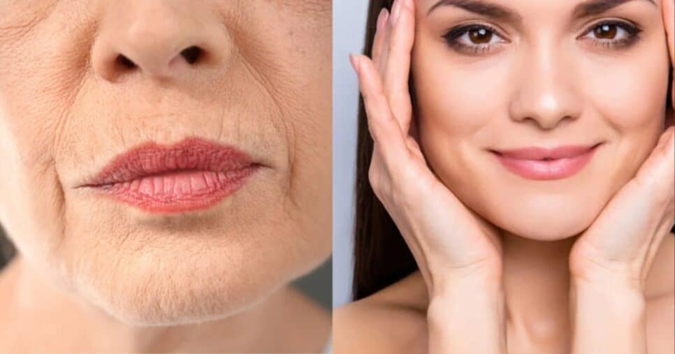 Harmonização facial caseira em 15 min (Foto: Reprodução/ Internet)