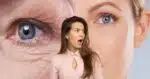 Harmonização facial elimina rugas e manchas (Reprodução/Montagem TV Foco/Canva)