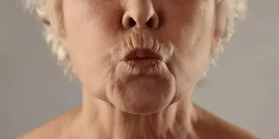 Adeus rugas em menos de 15 minutos: Único ingrediente rejuvenesce mulheres 50+ em 20 anos