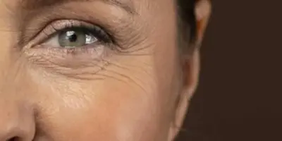 Exilir da juventude: Creme antirrugas totalmente caseiro rejuvenesce as 60+ em minutos