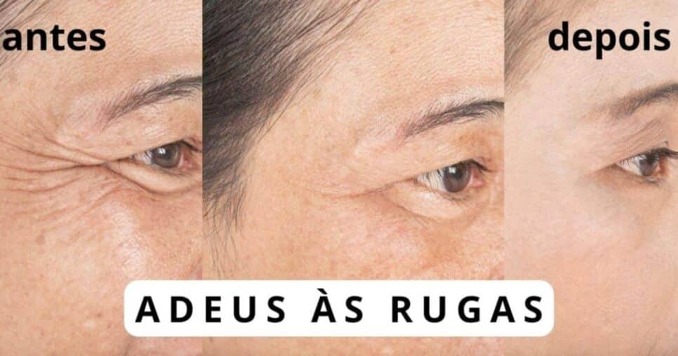 Receitinha com 4 ingredientes extermina às rugas e manchas das 50+ - Foto: Internet