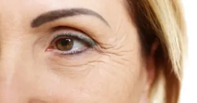 Tchau, rugas: Colágeno caseiro com 5 ingredientes rejuvenesce às 50+ em até 20 anos