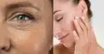 Com rugas / Sem rugas - Montagem: TVFOCO