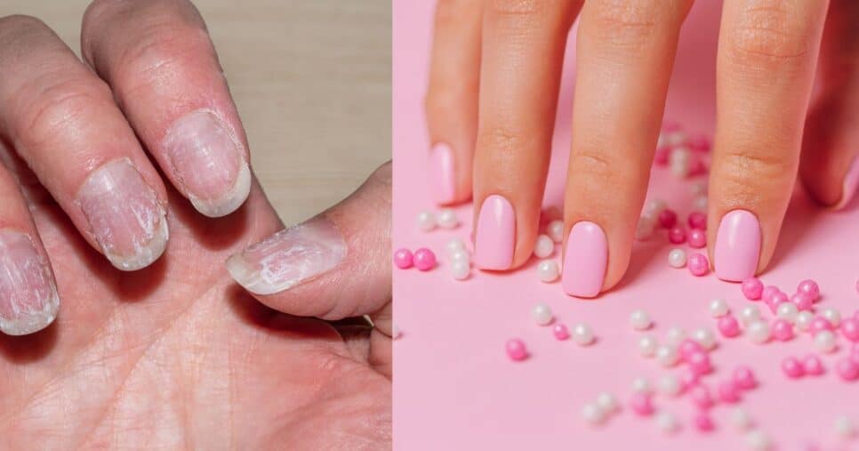 Como cuidar das unhas após o alongamento em gel (Fotos: Canva)