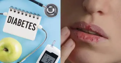 Alerta de diabetes: 7 sinais na boca indicam açúcar no sangue totalmente fora de controle