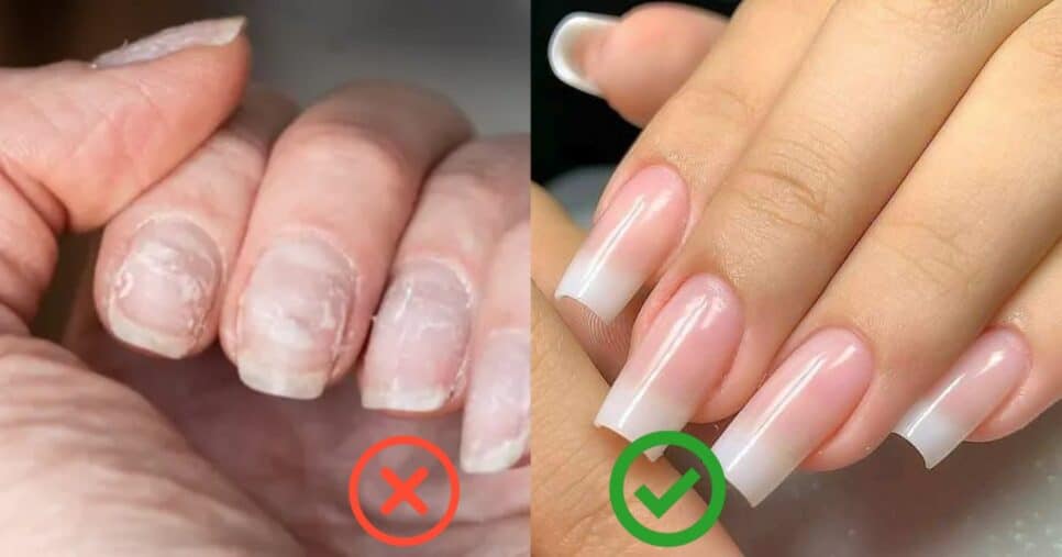 Fim das unhas quebradiças: 9 dicas para dar adeus a manicure (Foto: Reprodução/ Internet)