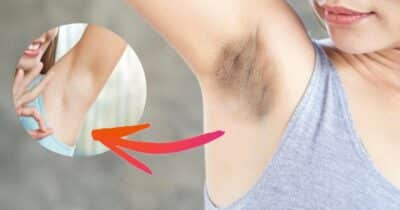 Fim do pelo encravado e manchas: 4 receitas para clarear axilas (Foto: Reprodução/ Internet)