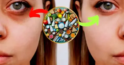 Fim das olheiras e manchas: Mistura caseira com 2 ingredientes acabam com o olhar cansado em 10 minutos