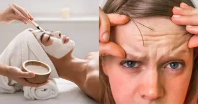 Pele de porcelana eternamente: Máscara natural com 2 ingredientes suga rugas e triplica o colágeno da pele