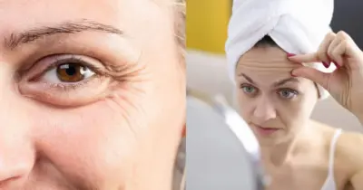 Taping facial: Técnica natural acaba rugas e linhas de expressão de mulheres 40+ sem sair de casa