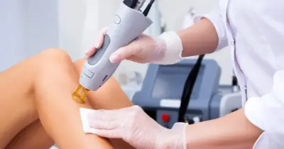 Efeito de depilação a laser: Mistura natural com 2 ingredientes tira pelos e traz pele lisinha