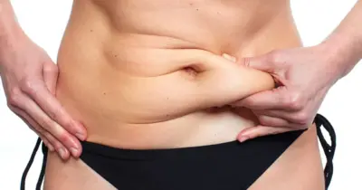 Tchau, gordura localizada: 2 ingredientes populares eliminam barriga das 40+
