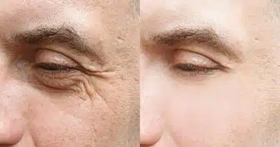 Receita caseira com 2 ingredientes rejuvenesce a pele (Foto: Divulgação)