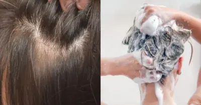 Tchau, grisalho: Shampoo caseiro de café e +4 ingredientes cobre até a raiz dos fios brancos das 60+