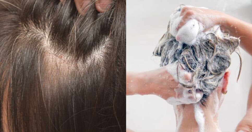 Shampoo caseiro elimina cabelo branco (Foto: Divulgação)