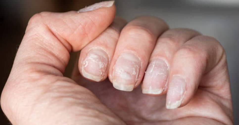 Veja como ter unhas mais saudáveis de forma natural (Foto: Reprodução/iStock)