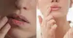 Adeus lábios ressecados: Misturinha hidrata de dentro pra fora (Foto: Reprodução/ Internet)