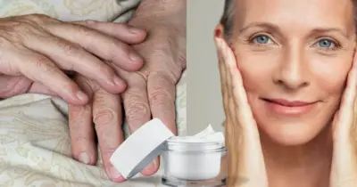 Rejuvenescem 20 anos: Use esse creme com 4 ingredientes para dar fim as mãos secas com rugas e manchas