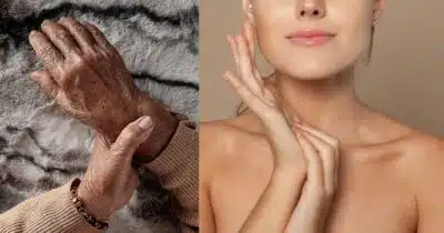 Mãos com rugas e modelo (Fotos: Reproduções / Canva)