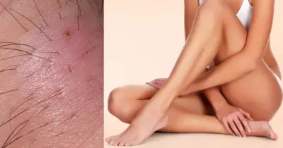 Tchau, pelo encravado e bolinhas: 5 truques infalíveis para depilar a perna com lâmina e ter pele lisinha