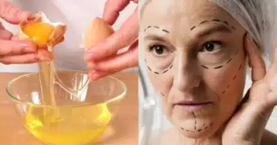 Receita para rugas na pele do pescoço (Foto: Montagem/TV Foco)
