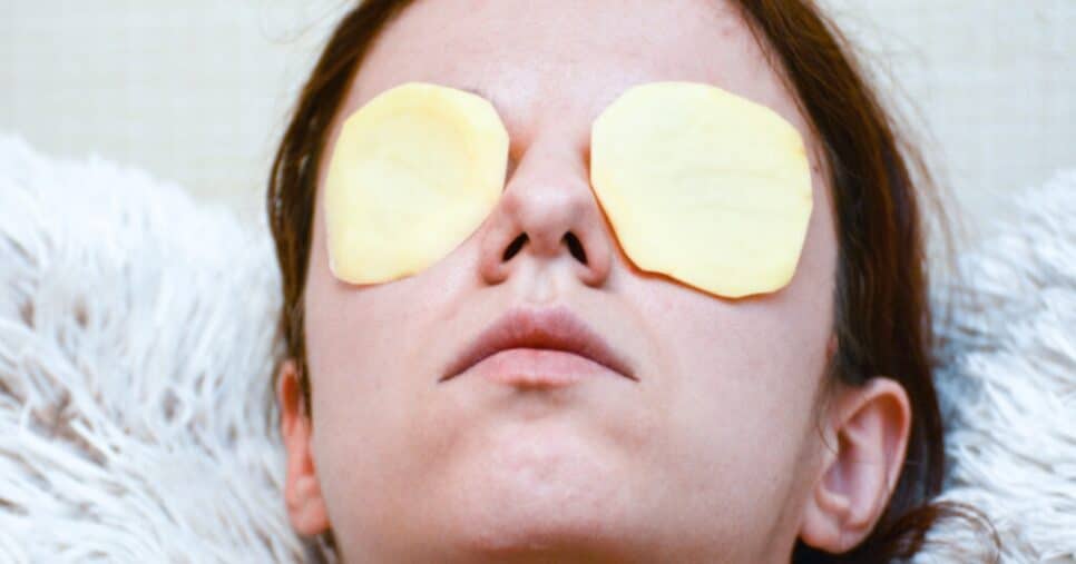 Rodela de batata nos olhos (Foto: Reprodução/ Internet)