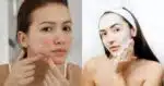 Sabonete caseiro com 3 ingredientes elimina manchas e acnes (Reprodução/Montagem TV Foco/Canva)