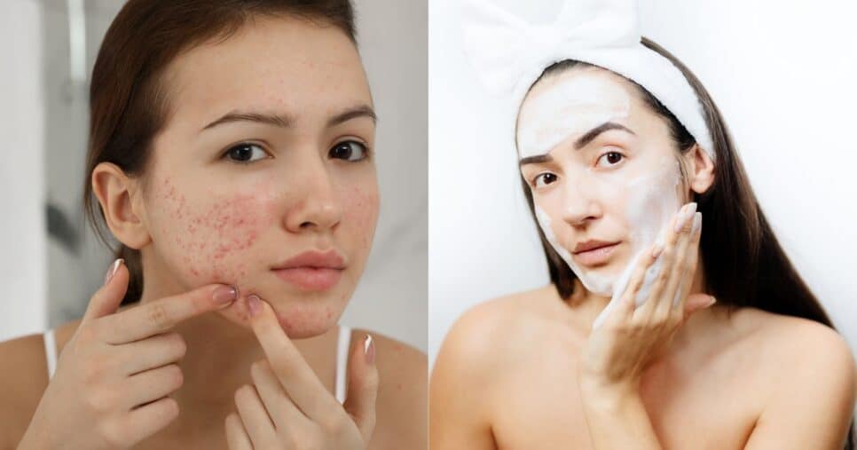 Sabonete caseiro com 3 ingredientes elimina manchas e acnes (Reprodução/Montagem TV Foco/Canva)