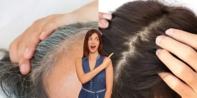 Matizador caseiro com ingrediente n°1 de cozinha elimina o cabelo branco em 2 passos