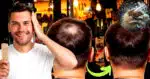 Solução para calvície pode ser encontrada no café e mais 2 ingredientes (Foto: Reprodução/Montagem/Lennita/Tv Foco/Canva)