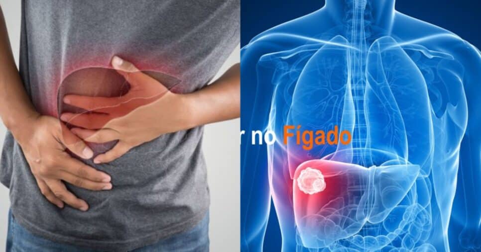 Confirmado motivo nº1 para diagnóstico de câncer de fígado com alerta máximo aos 60+ - Foto: Internet
