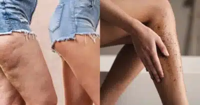 Imagem PreCarregada