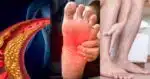 5 sinais silenciosos nos pés que indicam colesterol nas alturas nos 50+ - Foto: Internet
