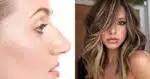 Cortes de cabelo que vão disfarçar o nariz grande e serão melhores que Rinoplastia (Foto: Montagem)