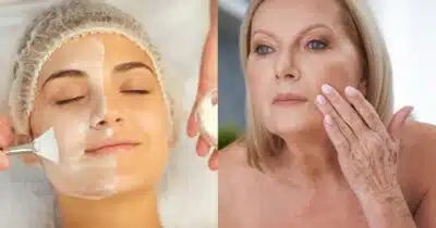 Harmonização facial caseira com 2 ingredientes traz carinha de 30 - (Montagem / TV FOCO)