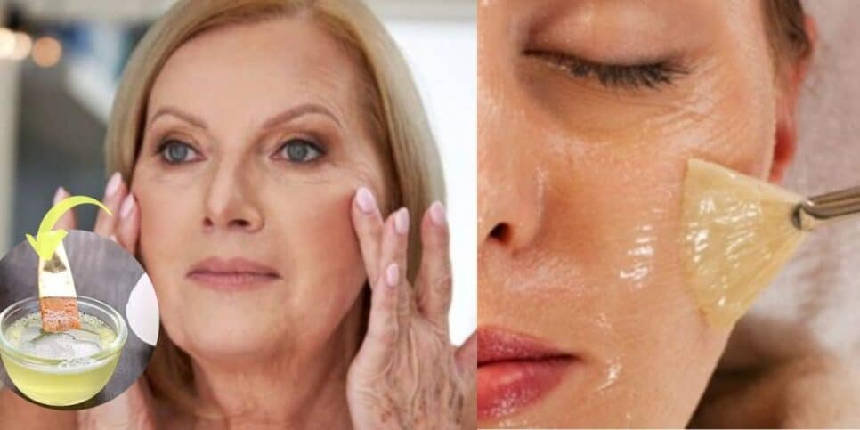 Lifting facial caseiro para rugas (Foto: Internet)