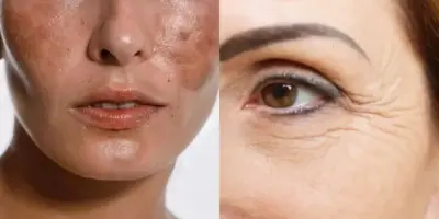 Diga adeus às rugas e manchas: 1 único ingrediente que você usa como tempero garante pele de bebê às 50+