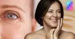 Mulher com e sem rugas (Foto: Reprodução / Canva / Montagem TV Foco)