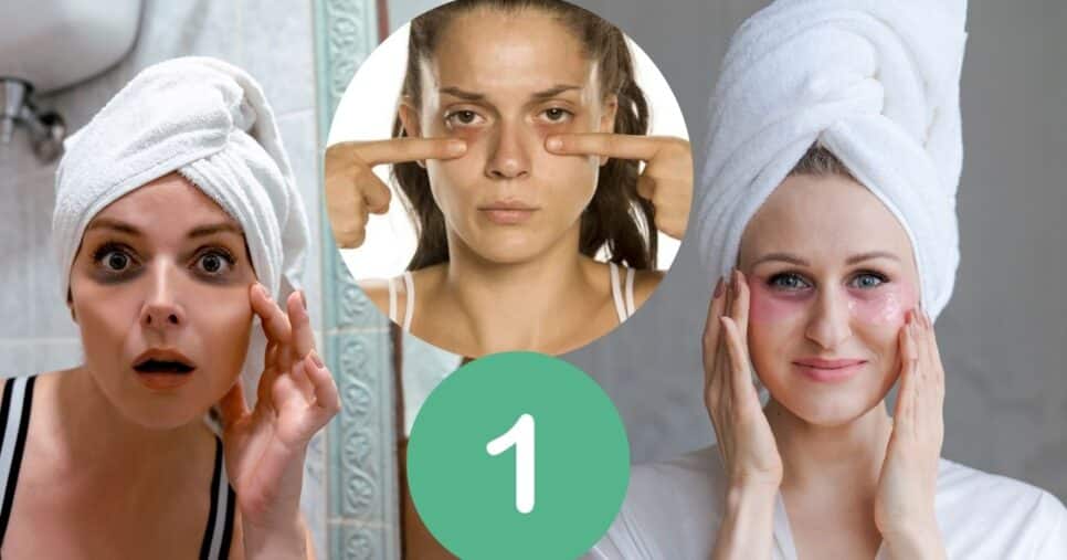 Mulher com e sem olheiras (Foto: Reprodução / Canva / Montagem TV Foco)