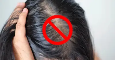 Fim do cabelo oleoso mesmo sem lavar: 5 ingredientes mágicos trazem o aspecto de limpo aos fios em 10 minutos