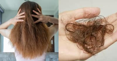 4 truques para ressuscitar o cabelo e acabar com a queda (Foto: Montagem)