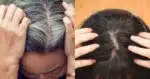 Receitinha caseira com 3 ingredientes cobre fios brancos de mulheres 60+ - Foto: Internet