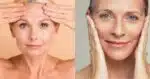 Mistura dá fim as manchas - (Montagem / TV FOCO)