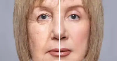 Tchau rugas, espinhas e manchas: Único ingrediente natural popular salva pele das 45+