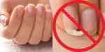 Deixe as unhas fortes com 3 ingredientes naturais (Reprodução: Montagem TV Foco)