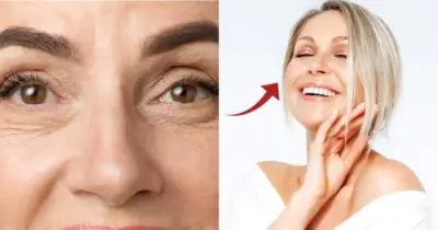 Carinha de 30 em 20 minutos: Botox caseiro com 2 ingredientes suga as rugas e estica a pele das 60+