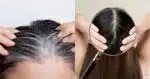 Fim do cabelo branco: Mistura poderosa cobre fios até as pontas (Foto: Reprodução/ Internet)