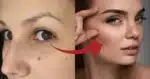Misturinha faz a sobrancelha crescer rápido e +grossa em 1 mês (Foto: Reprodução/ Internet)