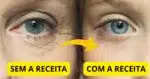 Receita para rugas - Montagem: TVFOCO